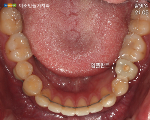 8dbb9c7678773e518044acaf7f402b62_004 (1).png