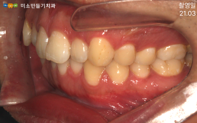 8dbb9c7678773e518044acaf7f402b62_SE-2c30e04b-b5d7-4511-b57a-b8d1bb1a3263.png