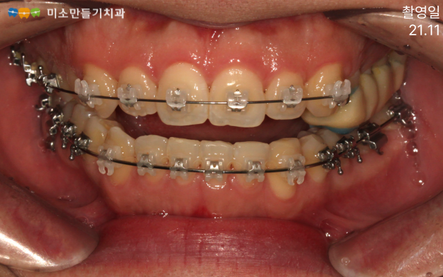 8dbb9c7678773e518044acaf7f402b62_SE-ea9adeac-f8ff-495f-9174-c4efbbe64a86.png