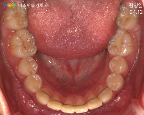 8dbb9c7678773e518044acaf7f402b62_�Ȼ걳��ġ�� (3).png