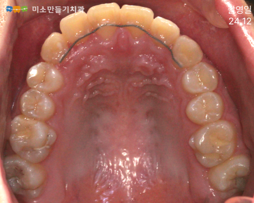 8dbb9c7678773e518044acaf7f402b62_�Ȼ걳��ġ�� (5).png