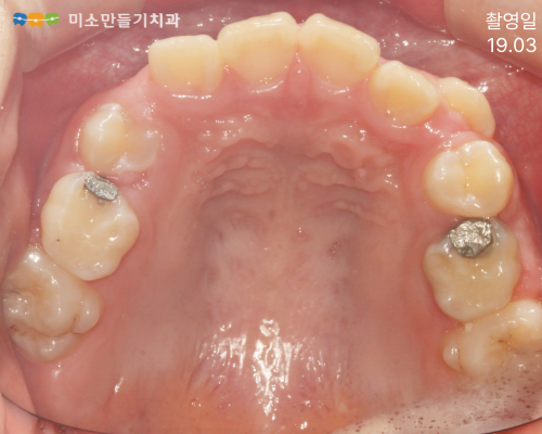 8dbb9c7678773e518044acaf7f402b62_�Ȼ걳��ġ�� (6).png