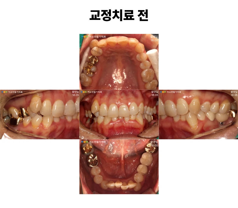 8dbb9c7678773e518044acaf7f402b62_�Ȼ�ġ�Ʊ��� (1).png