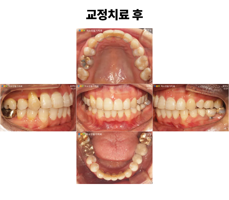 8dbb9c7678773e518044acaf7f402b62_�Ȼ�ġ�Ʊ��� (2).png