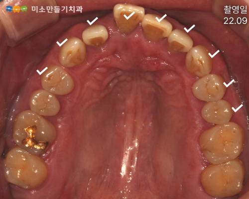 8dbb9c7678773e518044acaf7f402b62_002 (1).png