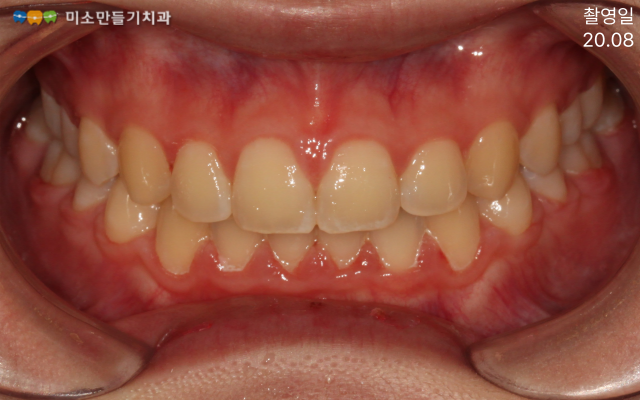 8dbb9c7678773e518044acaf7f402b62_007 (1).png