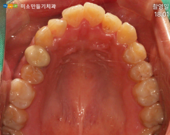 8dbb9c7678773e518044acaf7f402b62_���汳�ձ��� (5).png