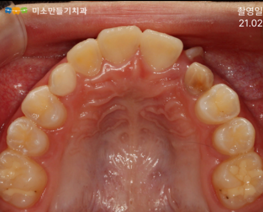 8dbb9c7678773e518044acaf7f402b62_��̸ź�ġ���� (17).png