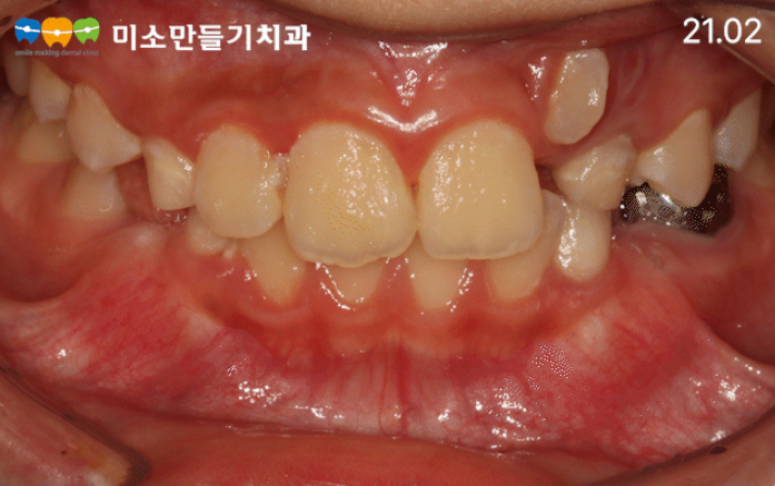 8dbb9c7678773e518044acaf7f402b62_��̸ź�ġ���� (9).png