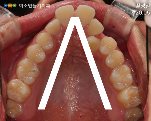 8dbb9c7678773e518044acaf7f402b62_�䳢�̻����� (6).png