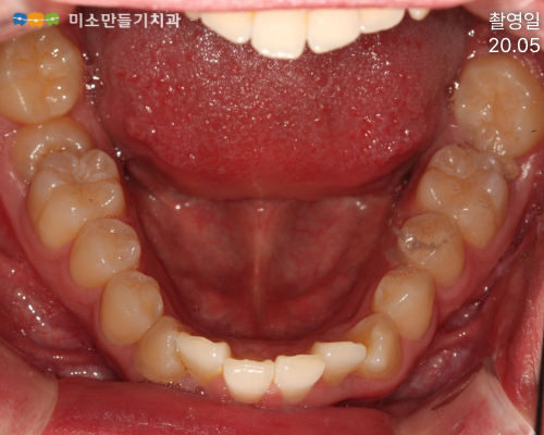8dbb9c7678773e518044acaf7f402b62_�䳢�̻����� (8).png