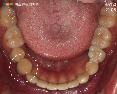 8dbb9c7678773e518044acaf7f402b62_008 (1).png