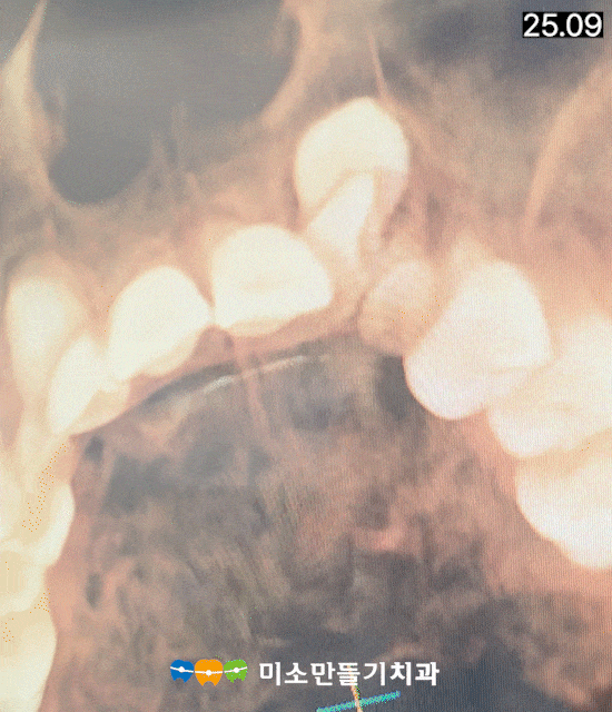 8dbb9c7678773e518044acaf7f402b62_Sequence_08_2-min.gif